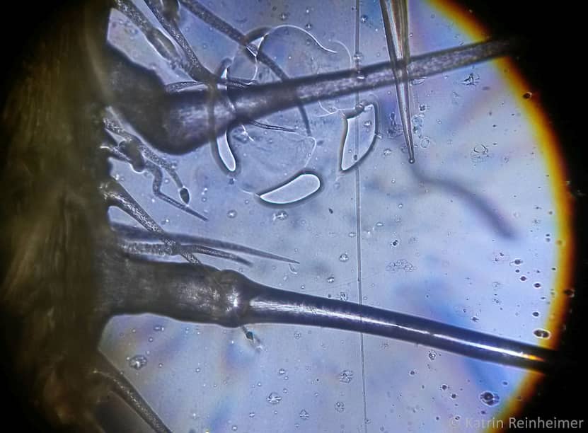 Mikroskopaufnahme von Brennhaaren mit Sollbruchstelle.