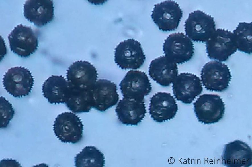Löwenzahn-Pollen unter dem Mikroskop.